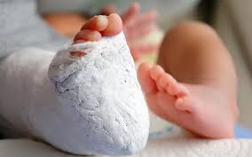 Common Orthopedic Injuries in Newborns